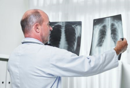 Exames para diagnóstico de problemas respiratórios